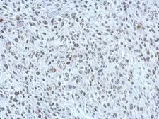 Anti-POM121 antibody [N2N3] used in IHC (Paraffin sections) (IHC-P). GTX102128