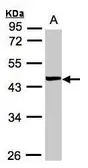Anti-VPS72 antibody [N1C1] used in Western Blot (WB). GTX102152