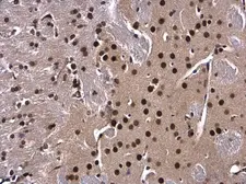 Anti-XBP1 antibody [N3C3] used in IHC (Paraffin sections) (IHC-P). GTX102229