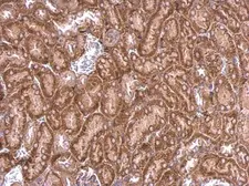 Anti-PPEF2 antibody used in IHC (Paraffin sections) (IHC-P). GTX102536