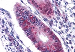 Anti-DDX5 antibody, C-term used in IHC (Paraffin sections) (IHC-P). GTX10261