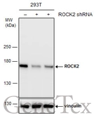 Anti-ROCK2 antibody used in Western Blot (WB). GTX102619
