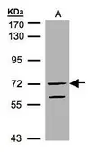 Anti-RAPGEF5 antibody used in Western Blot (WB). GTX102629