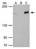 Anti-Topoisomerase II beta antibody [C3], C-term used in Immunoprecipitation (IP). GTX102640