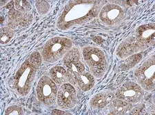 Anti-MCCC2 antibody [N1C1] used in IHC (Paraffin sections) (IHC-P). GTX102674
