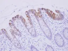 Anti-Biglycan antibody used in IHC (Paraffin sections) (IHC-P). GTX102765
