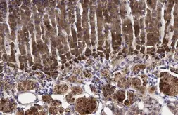 Anti-HSD3B2 antibody [N3C3] used in IHC (Paraffin sections) (IHC-P). GTX102813