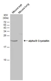 Anti-alpha B Crystallin antibody [N1C3] used in Western Blot (WB). GTX103053