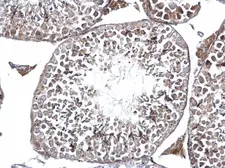 Anti-DMC1 antibody [N1C1] used in IHC (Paraffin sections) (IHC-P). GTX103062