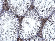 Anti-TrxR1 antibody [N1N3] used in IHC (Paraffin sections) (IHC-P). GTX103202