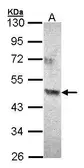 Anti-ACAD8 antibody [N3C3] used in Western Blot (WB). GTX103305