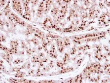Anti-ZNF323 antibody [N1C3] used in IHC (Paraffin sections) (IHC-P). GTX103378