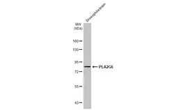 Anti-PLA2G6 antibody [N3C3] used in Western Blot (WB). GTX103717