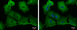 Anti-USP8 antibody used in Immunocytochemistry/ Immunofluorescence (ICC/IF). GTX103747
