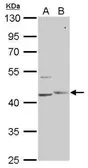 Anti-PHKG1 antibody [N1C3] used in Western Blot (WB). GTX104019