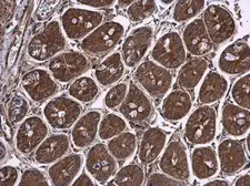 Anti-Pyruvate Dehydrogenase E1 beta subunit antibody used in IHC (Paraffin sections) (IHC-P). GTX104040