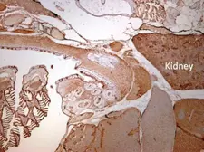 Anti-IDH3A antibody used in IHC (Paraffin sections) (IHC-P). GTX104073