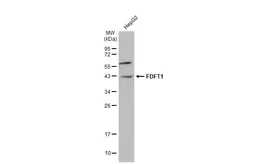 Anti-FDFT1 antibody [N2C3] used in Western Blot (WB). GTX104091