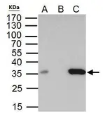 Anti-BRAF35 antibody used in Immunoprecipitation (IP). GTX104102
