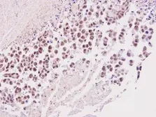 Anti-Timeless antibody [N1N2], N-term used in IHC (Paraffin sections) (IHC-P). GTX104334