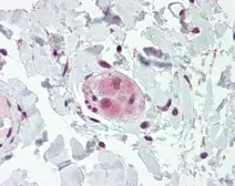 Anti-WRCH1 antibody used in IHC (Paraffin sections) (IHC-P). GTX104779