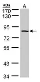 Anti-ADAM33 antibody [C2C3], C-term used in Western Blot (WB). GTX104804