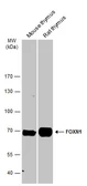 Anti-FOXN1 antibody [C3], C-term used in Western Blot (WB). GTX104849