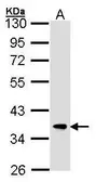 Anti-FBXL12 antibody [C2C3], C-term used in Western Blot (WB). GTX104870