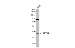 Anti-INPP5A antibody [N2C3] used in Western Blot (WB). GTX104929