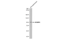Anti-ADAM10 antibody [N2C1], Internal used in Western Blot (WB). GTX104940