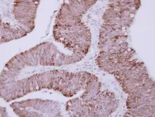 Anti-OTC antibody used in IHC (Paraffin sections) (IHC-P). GTX105140
