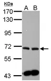Anti-SPHK2 antibody used in Western Blot (WB). GTX105152