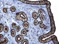 Anti-Cytokeratin 6 antibody used in IHC (Paraffin sections) (IHC-P). GTX105355