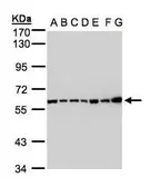 Anti-C2 / C2a antibody [N3C3] used in Western Blot (WB). GTX105404