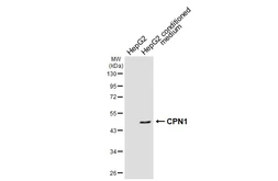 Anti-CPN1 antibody [N1C3] used in Western Blot (WB). GTX105515