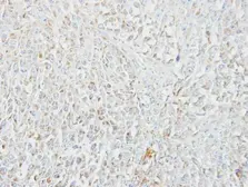 Anti-MIPEP antibody [N2C1], Internal used in IHC (Paraffin sections) (IHC-P). GTX105574