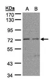 Anti-FLRT1 antibody [N1N3] used in Western Blot (WB). GTX105597