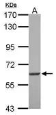 Anti-SGK3 antibody [N1N3] used in Western Blot (WB). GTX105604