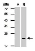 Anti-Dermatopontin antibody used in Western Blot (WB). GTX106150
