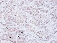 Anti-NSD2 antibody [N1], N-term used in IHC (Paraffin sections) (IHC-P). GTX106306