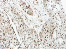 Anti-RanGAP1 antibody [N1], N-term used in IHC (Paraffin sections) (IHC-P). GTX106338