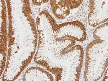 Anti-Centaurin alpha 1 antibody [C3], C-term used in IHC (Paraffin sections) (IHC-P). GTX106419