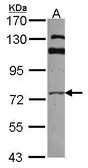 Anti-GGA3 antibody [C3], C-term used in Western Blot (WB). GTX106461