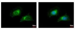 Anti-CARD6 antibody [N1N2], N-term used in Immunocytochemistry/ Immunofluorescence (ICC/IF). GTX106888