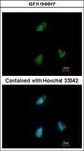 Anti-CLUAP1 antibody used in Immunocytochemistry/ Immunofluorescence (ICC/IF). GTX106897