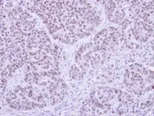 Anti-FHL5 antibody [N1C2] used in IHC (Paraffin sections) (IHC-P). GTX107031