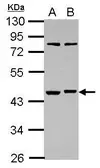 Anti-RBMS1 antibody [N1C2] used in Western Blot (WB). GTX107358