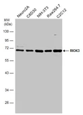 Anti-RIOK3 antibody used in Western Blot (WB). GTX107514