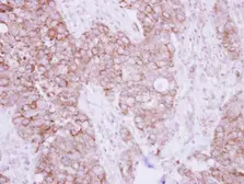 Anti-TBRG4 antibody used in IHC (Paraffin sections) (IHC-P). GTX107663