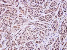 Anti-MVK antibody [N3C3] used in IHC (Paraffin sections) (IHC-P). GTX107761